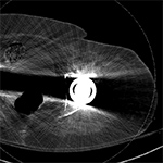 Artifact summation